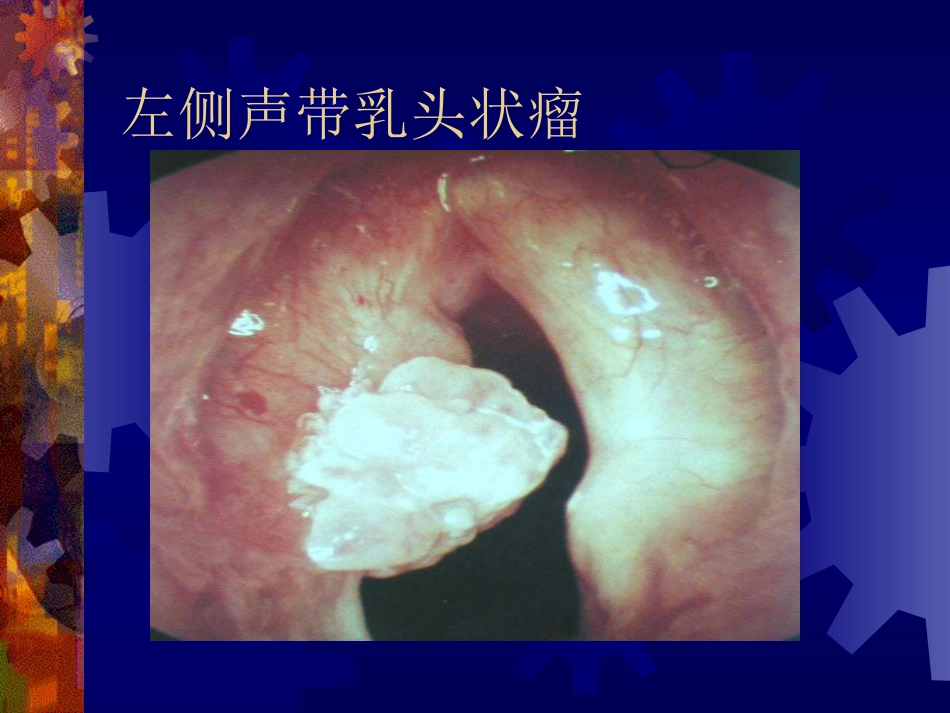 喉阻塞_第12页