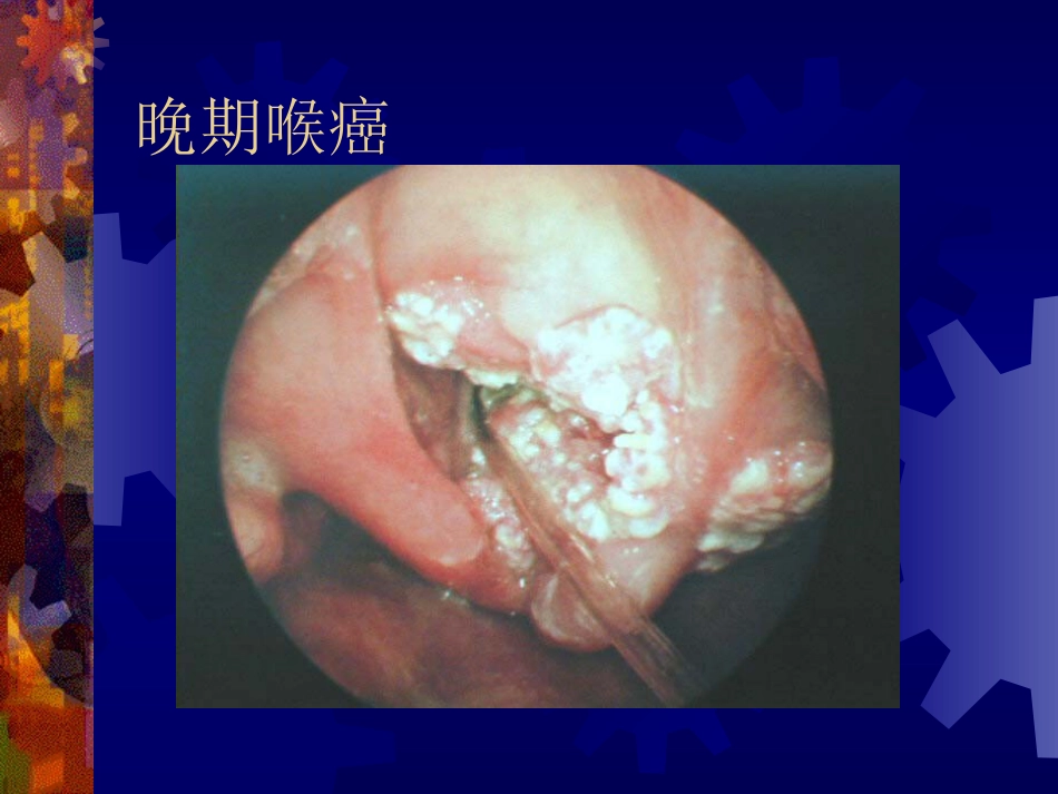 喉阻塞_第15页