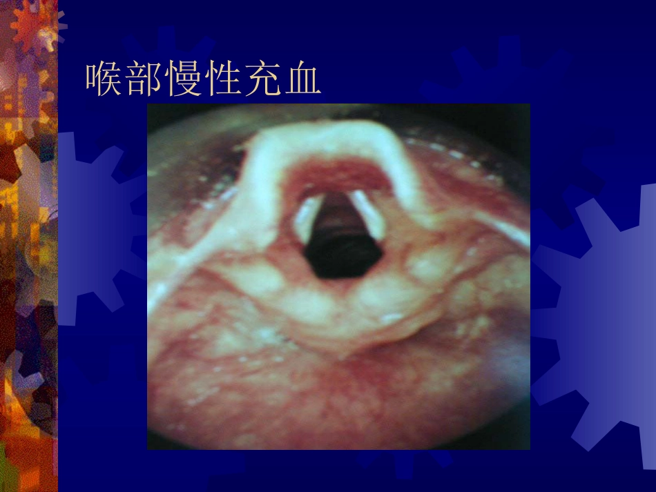 喉阻塞_第6页