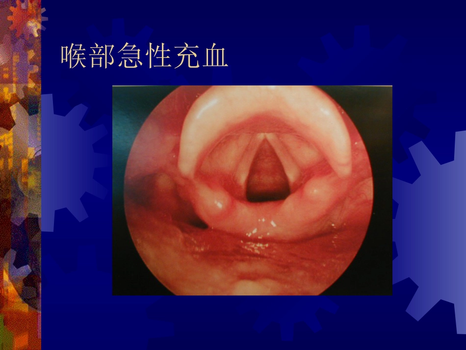 喉阻塞_第7页