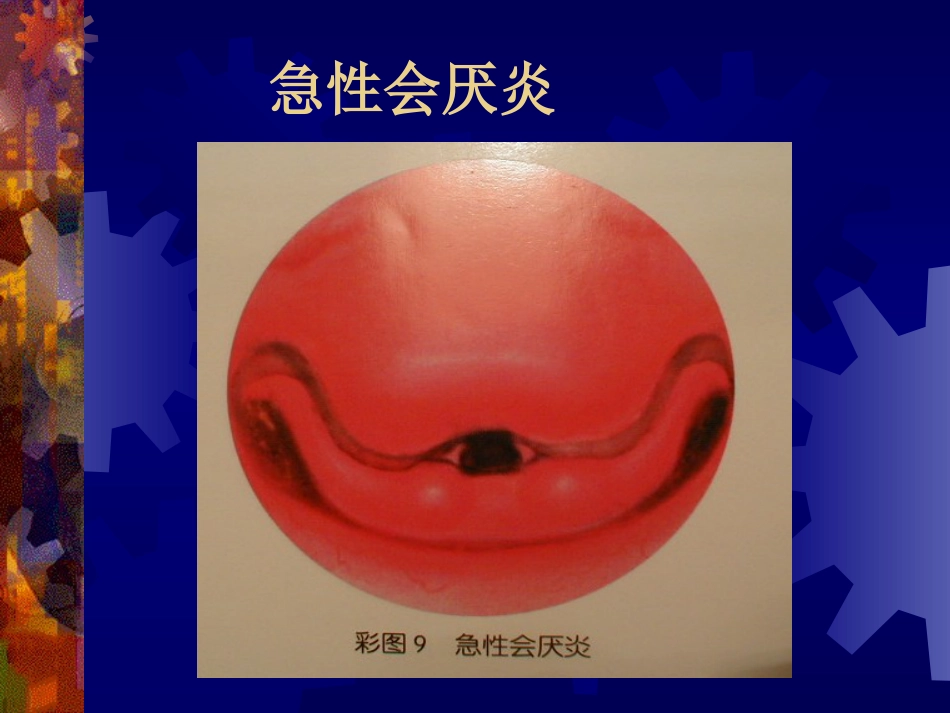 喉阻塞_第8页