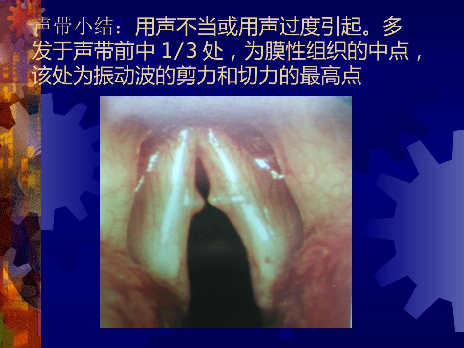 喉阻塞_第9页
