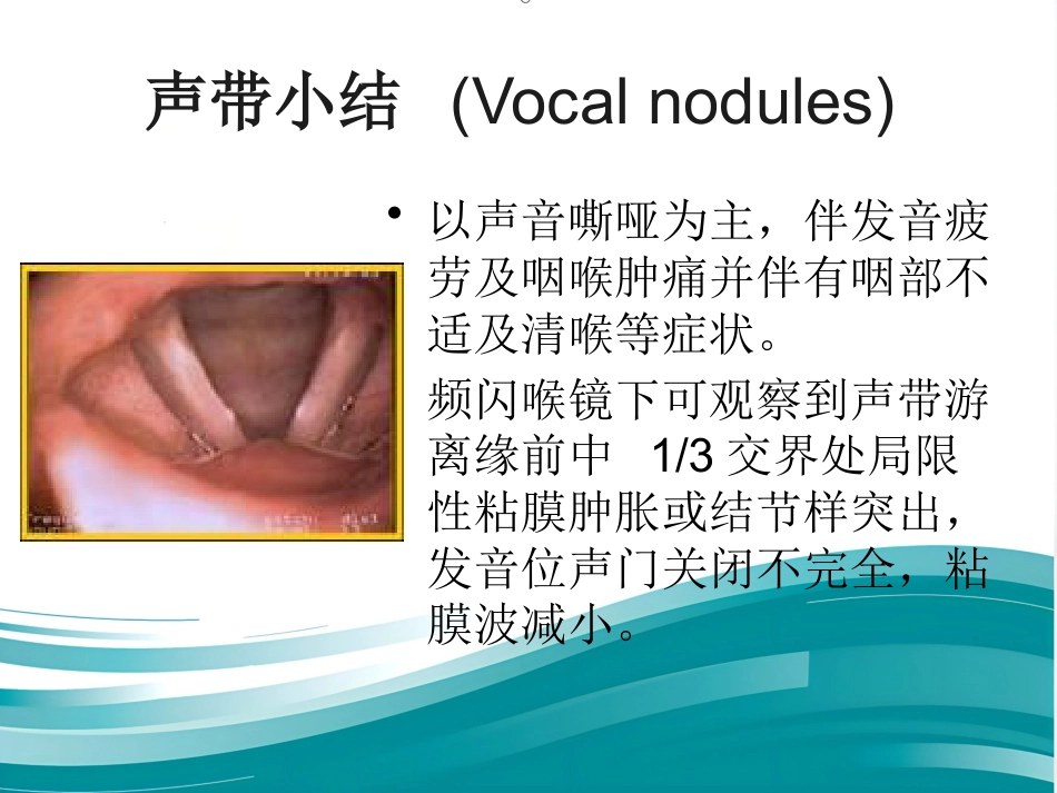 动态频闪喉镜的应用_第14页