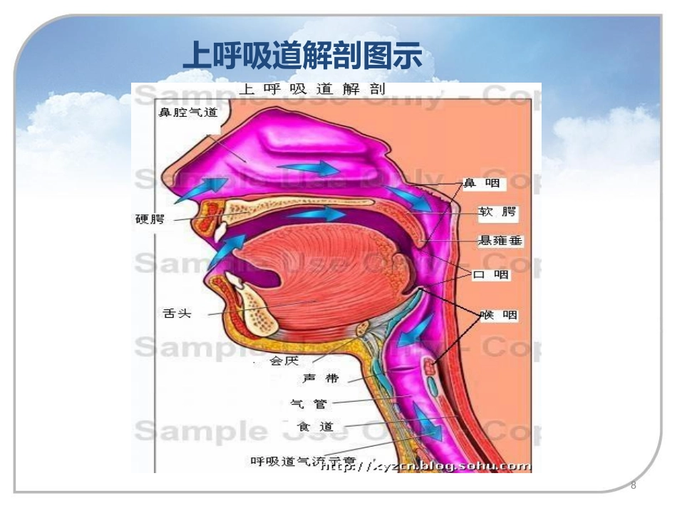 喉罩的进展及临床应用_第8页
