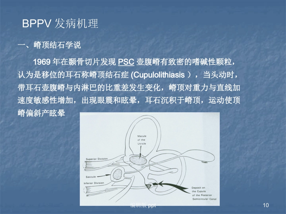 常见耳源性眩晕的诊断与治疗PPT课件_第10页