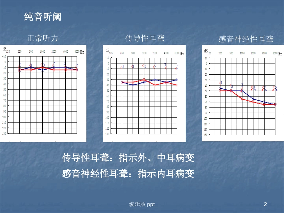 常见耳源性眩晕的诊断与治疗PPT课件_第2页