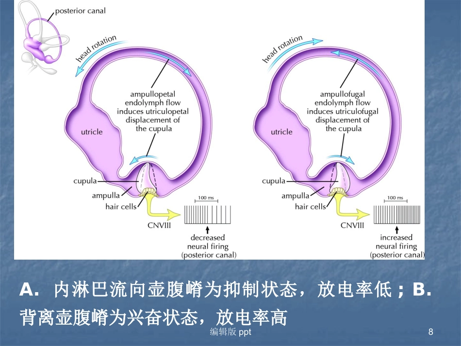 常见耳源性眩晕的诊断与治疗PPT课件_第8页