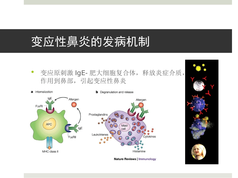 变应性鼻炎和免疫治疗_第4页