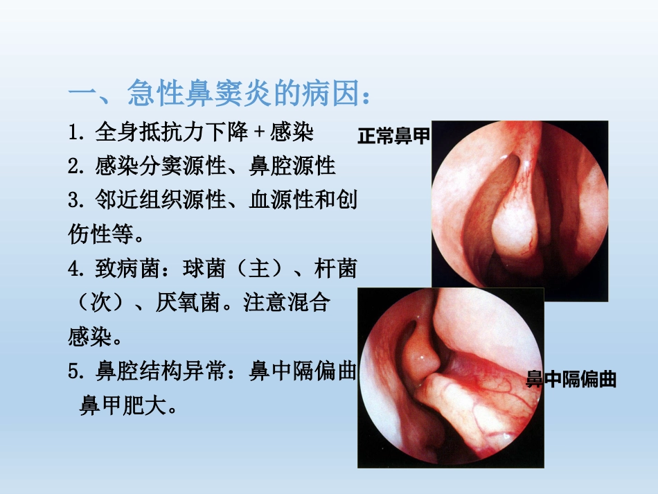 慢性鼻窦炎医疗业务学习_第14页