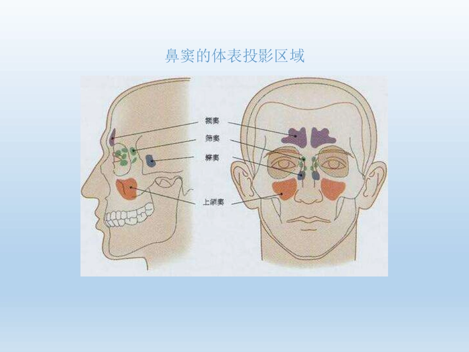 慢性鼻窦炎医疗业务学习_第5页