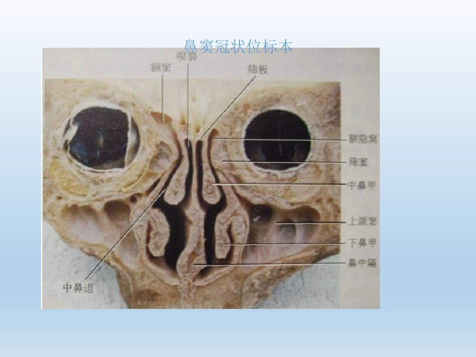 慢性鼻窦炎医疗业务学习_第6页