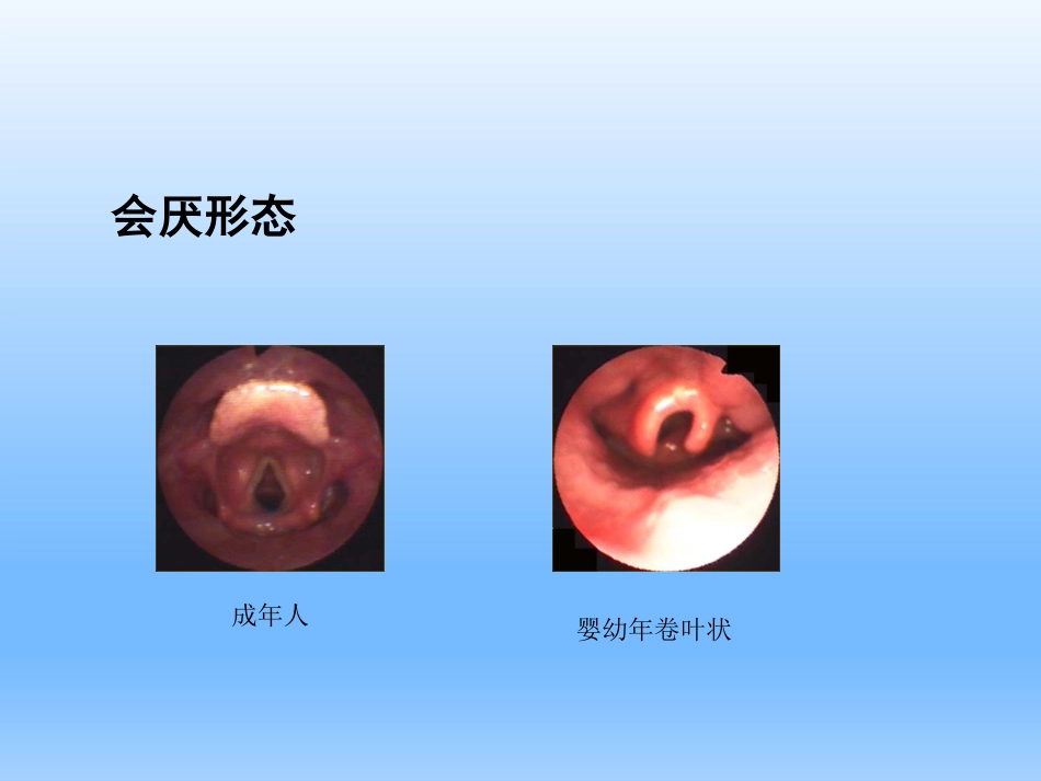 耳鼻咽喉头颈外科学——喉的解剖、生理、症状、检查_第12页