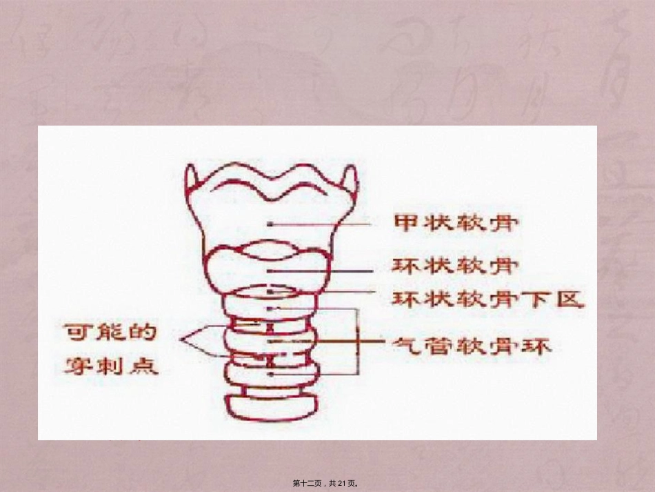 经口(鼻)气管插管改为经皮气管切开医护配合_第12页