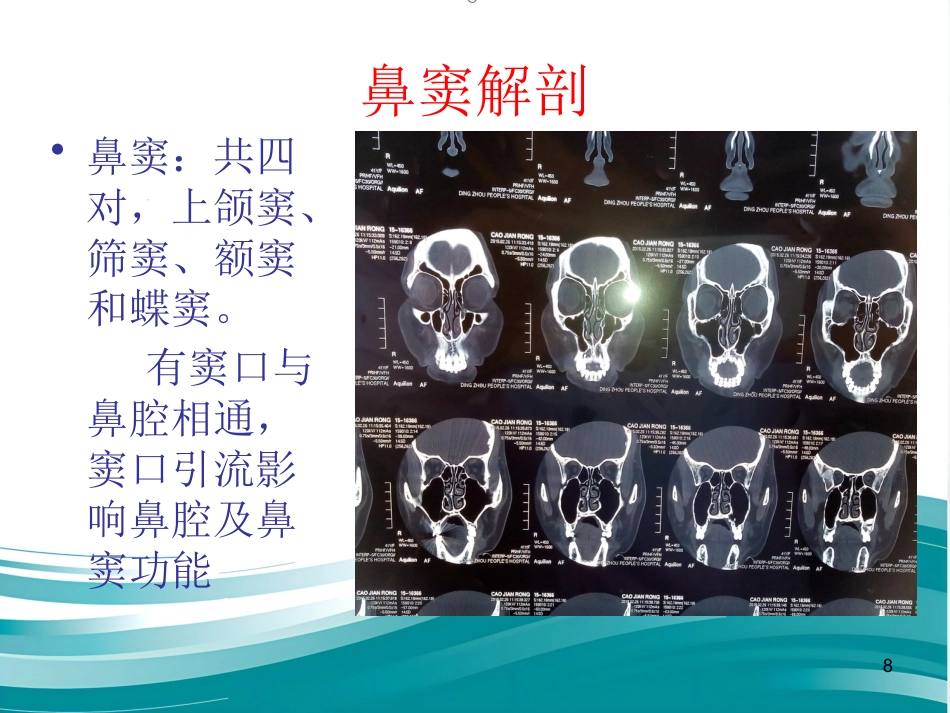 常见耳鼻喉疾病诊疗_第8页