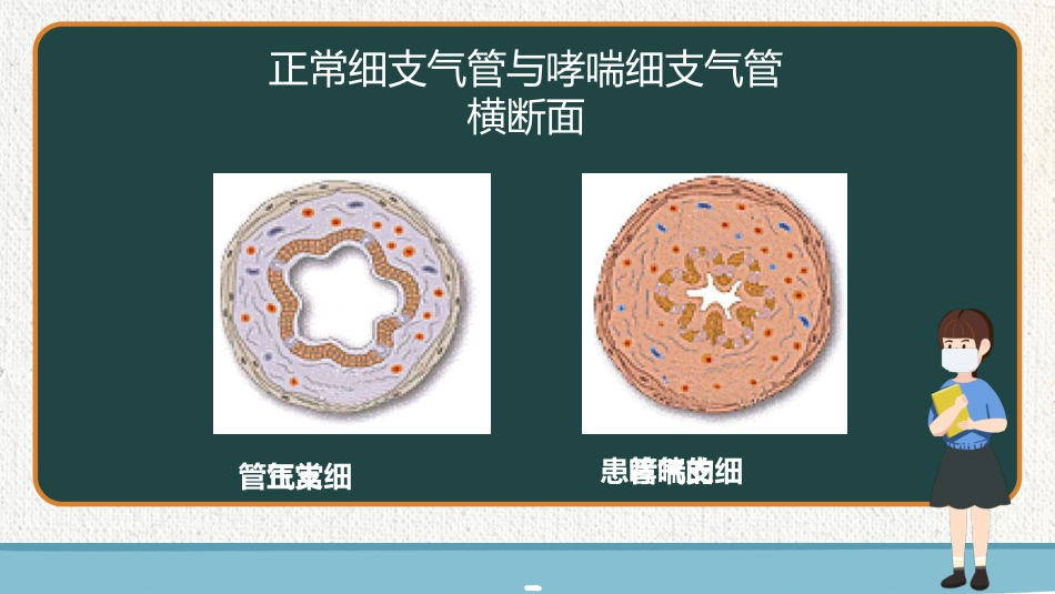 珍爱生命，控制哮喘_第7页