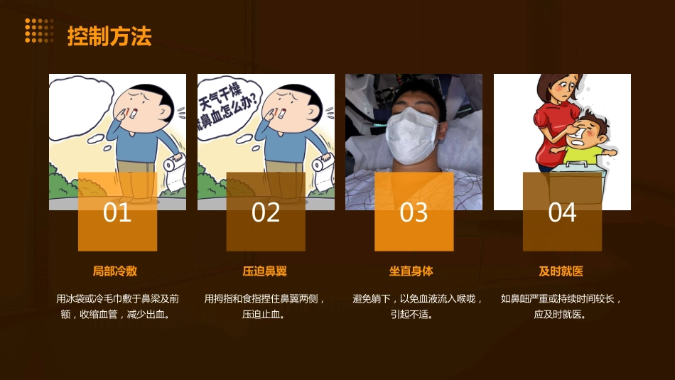 鼻衄ppt课件_第9页