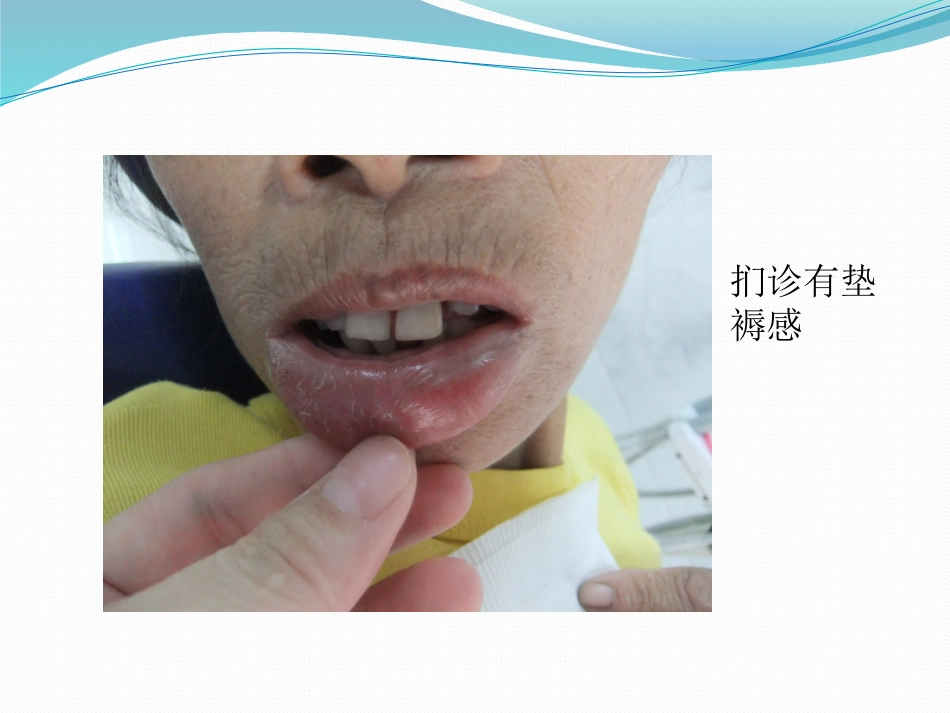 唇舌疾病 PPT_第11页