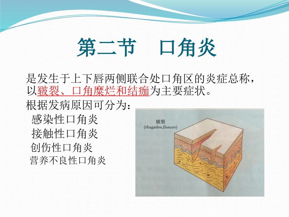 唇舌疾病 PPT_第13页