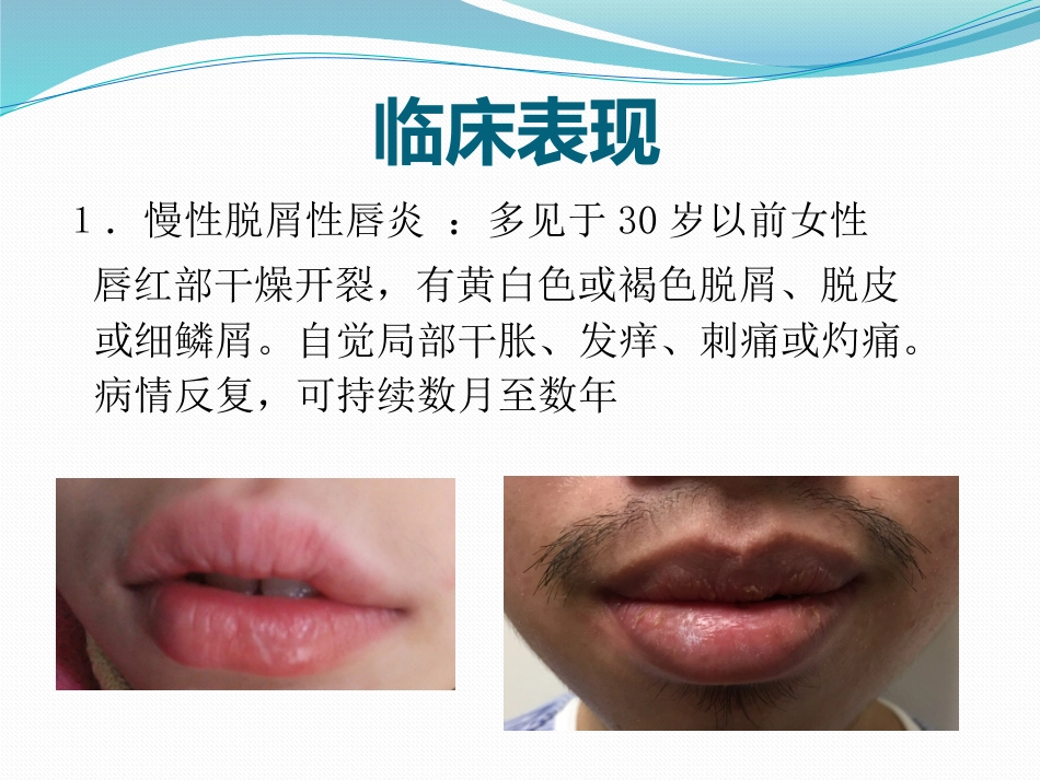 唇舌疾病 PPT_第4页