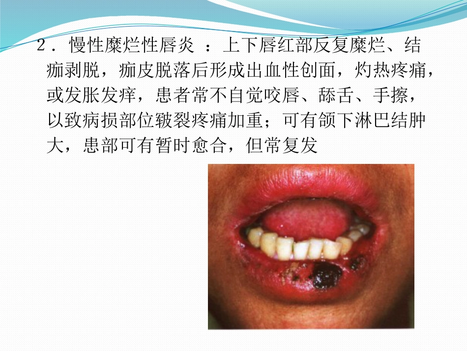 唇舌疾病 PPT_第6页