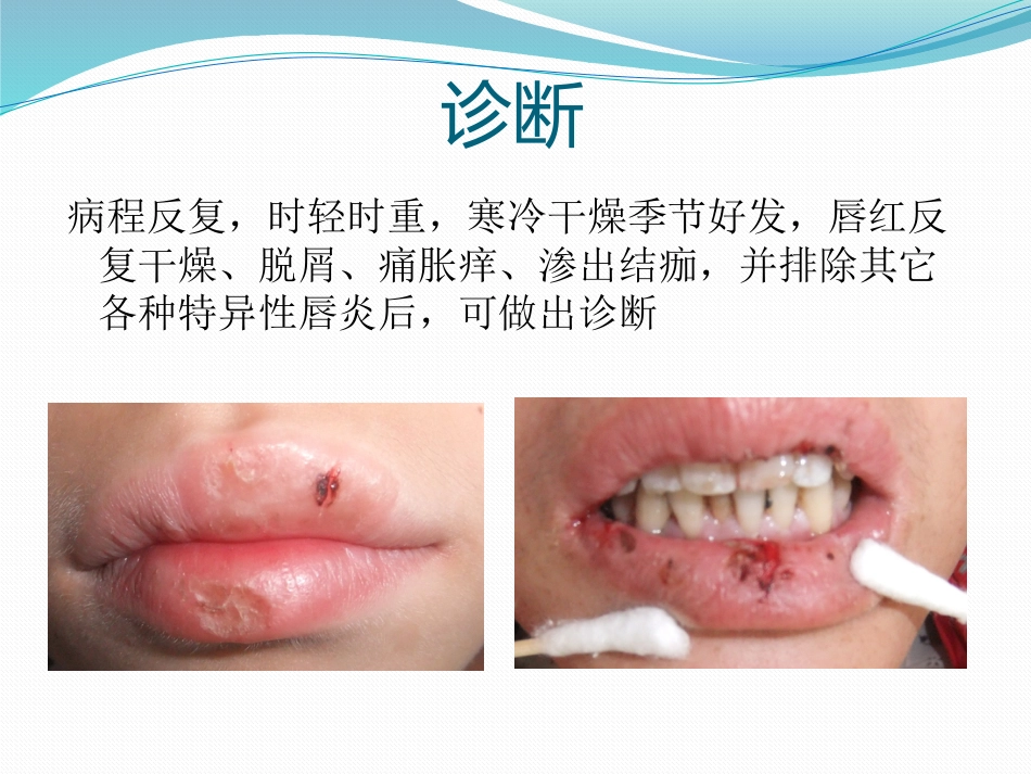 唇舌疾病 PPT_第7页