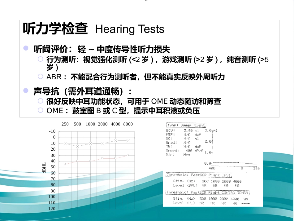 儿童分泌性中耳炎诊治 PPT_第12页