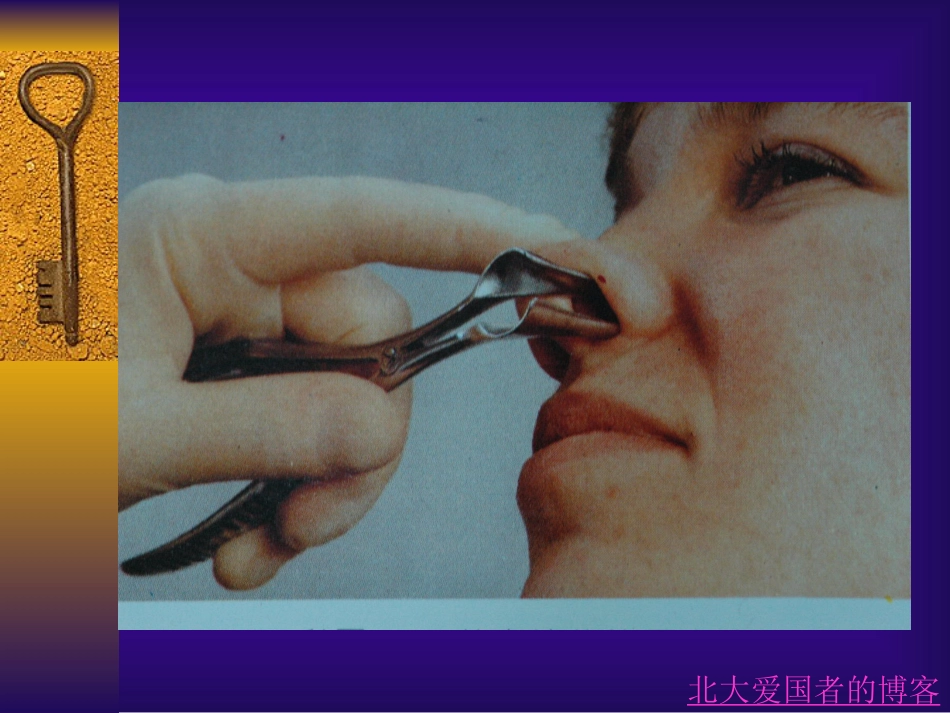 鼻部常见疾病_第9页
