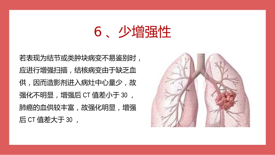 成人肺结核CT特征_第10页