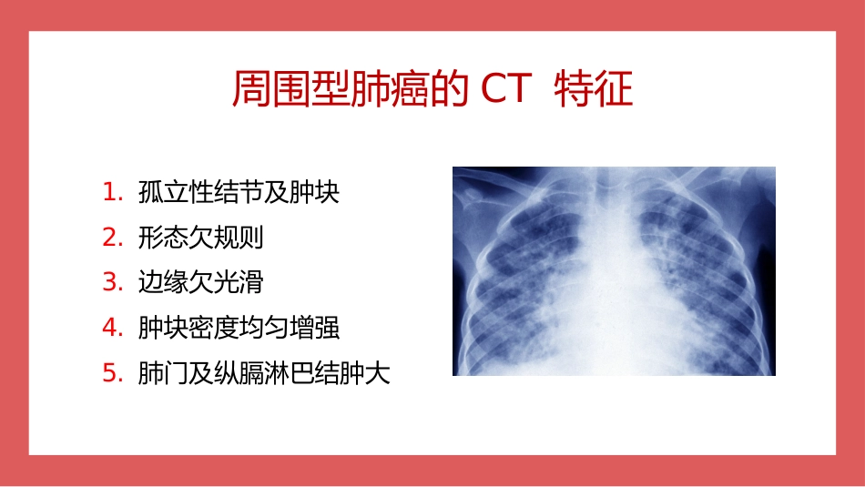 成人肺结核CT特征_第13页