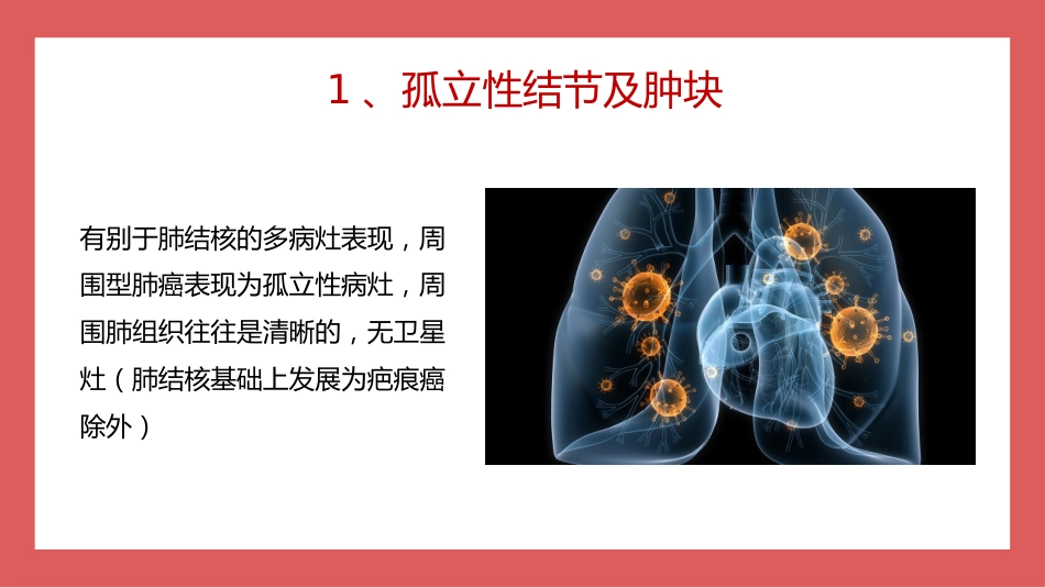成人肺结核CT特征_第14页