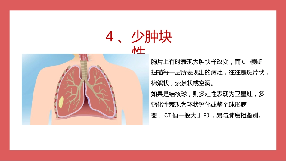 成人肺结核CT特征_第8页