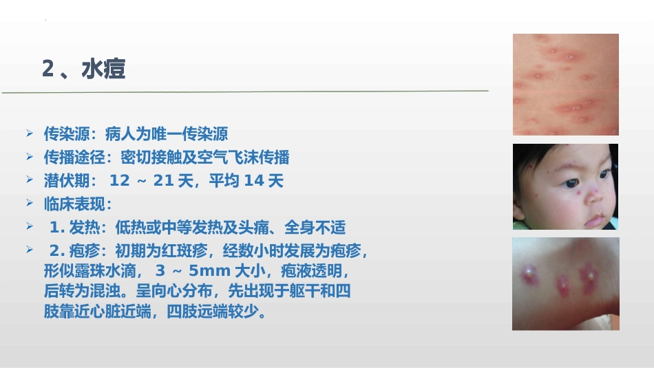 预防结核病及常见传染病专题教育_第5页
