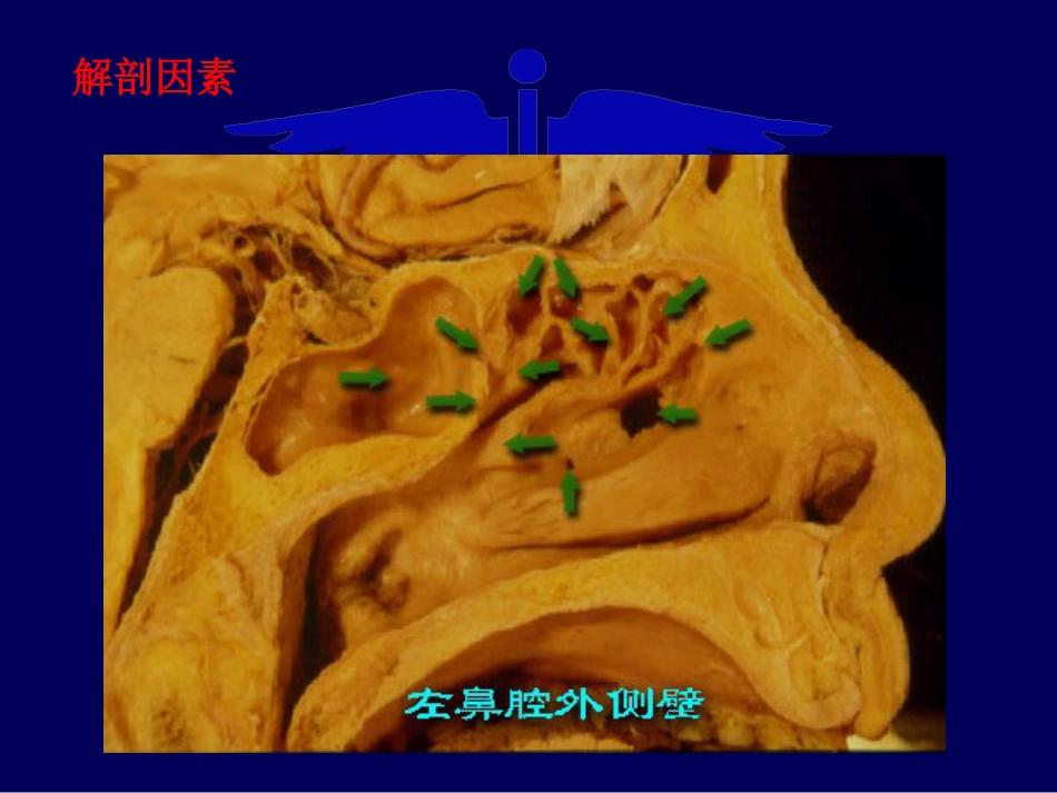 鼻窦炎诊治_第8页
