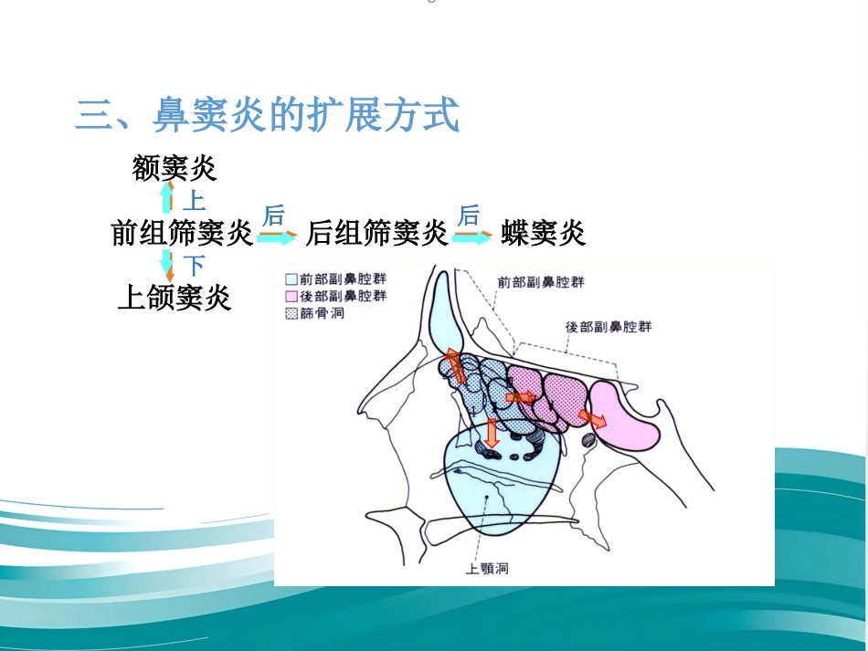 慢性鼻窦炎_第11页