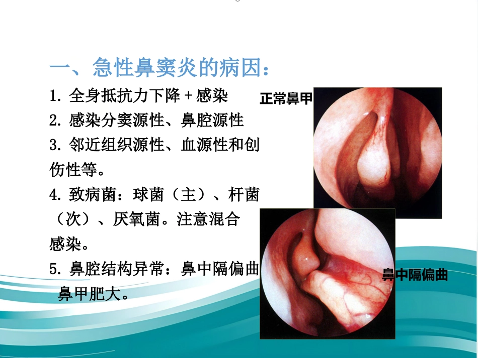 慢性鼻窦炎_第14页