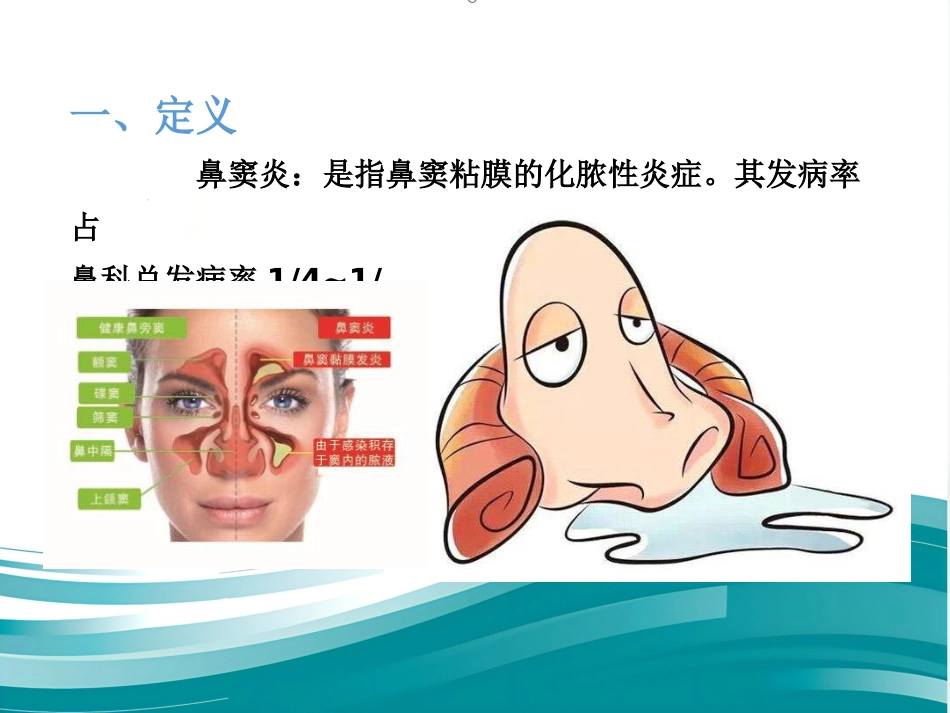 慢性鼻窦炎_第2页