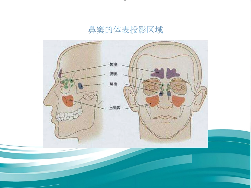 慢性鼻窦炎_第5页