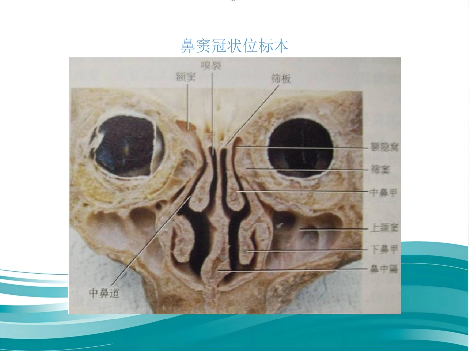 慢性鼻窦炎_第6页
