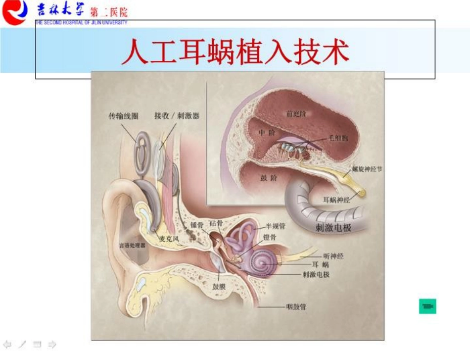 耳解剖剂分泌性中耳炎讲义_第11页