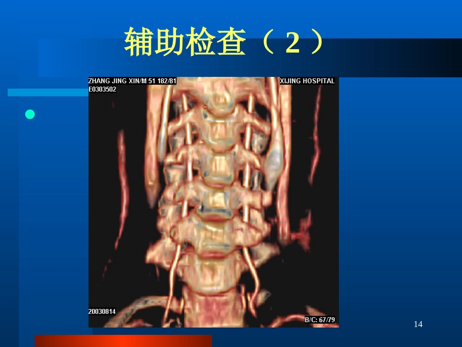 半规管前庭和耳蜗_第14页