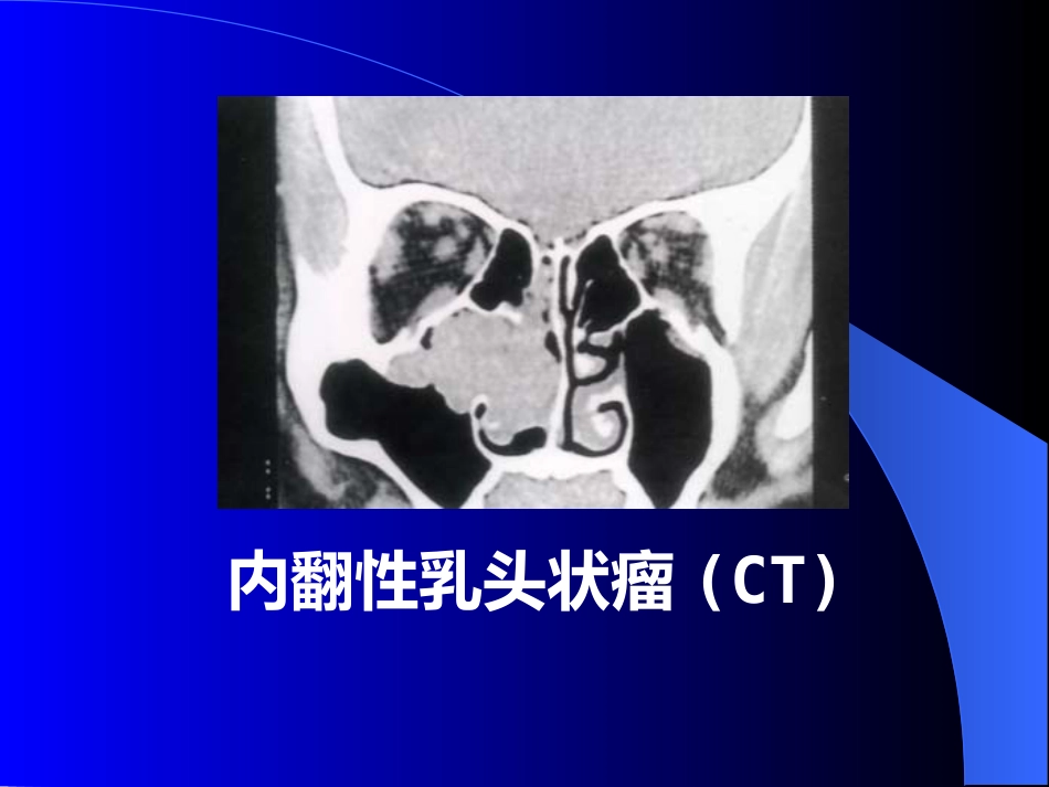 鼻窦炎医学_第11页