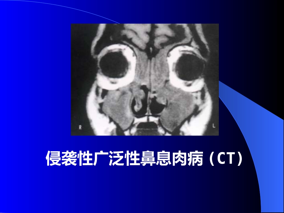 鼻窦炎医学_第12页
