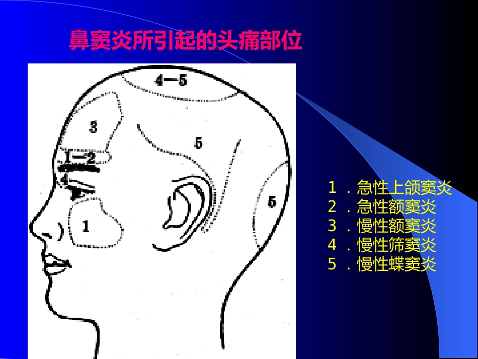 鼻窦炎医学_第8页