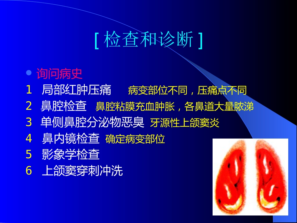 鼻窦炎医学_第9页