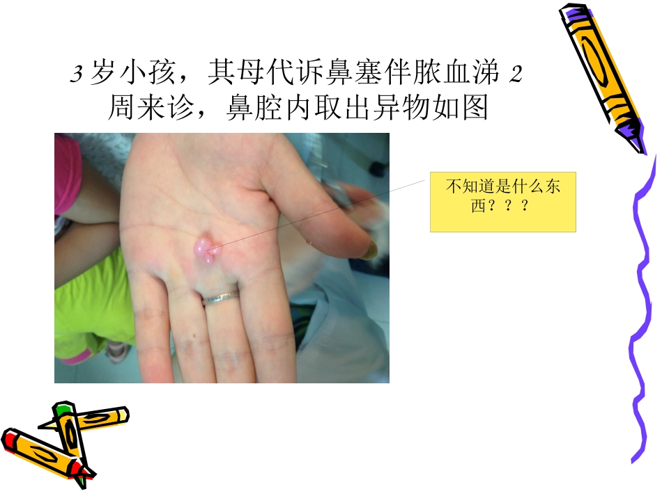 耳鼻喉科常见急症的处理_第12页