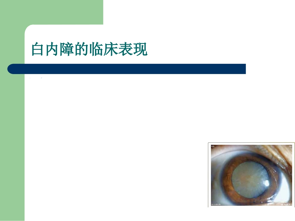 白内障护理查房_第12页