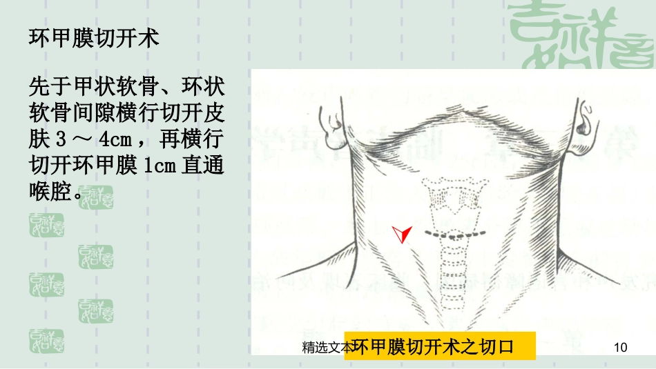 喉解剖_第10页