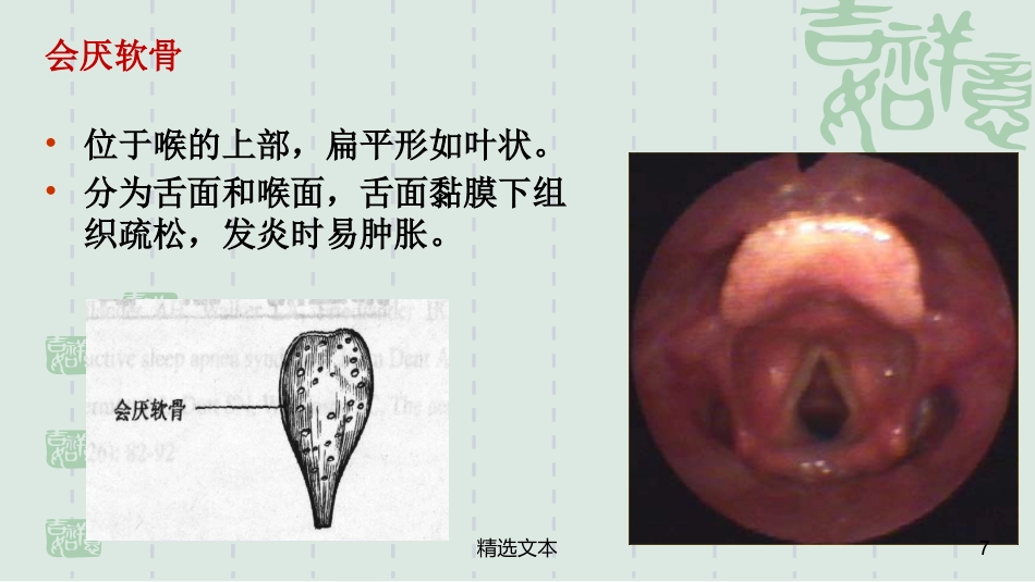 喉解剖_第7页
