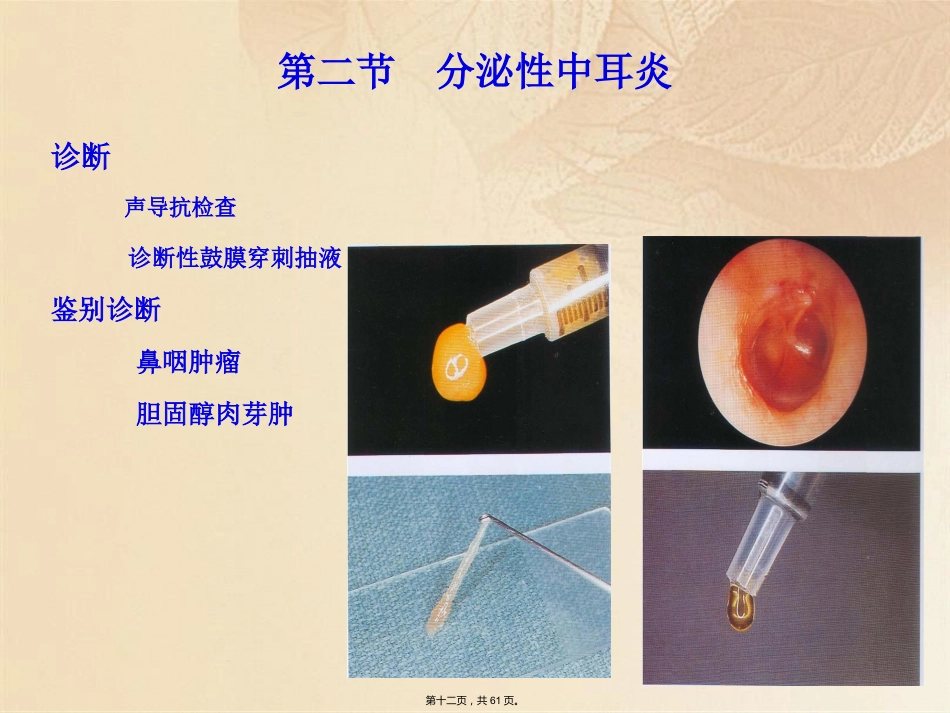 耳鼻咽喉头颈外科学耳部疾病_第12页