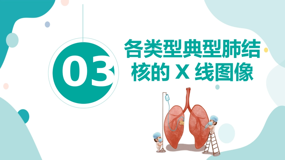 肺结核的护理_第9页